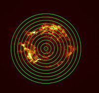 annulus cas a